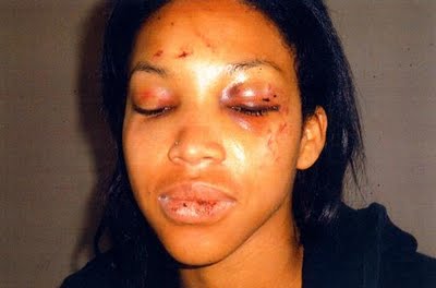 Battered Victim_LWTZE | AceWorldTeam.com